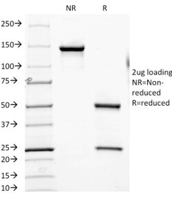 CD6 Antibody (SPV-L14), Novus Biologicals 0.2mg; Unlabeled:Antibodies,